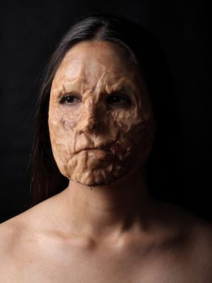 Piel de la cara convertida en una costra arrugada y agrietada que termina en el cuello