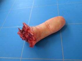 Dedo cortado con el extremo en carne viva, apoyado sobre una plancha de corte azul