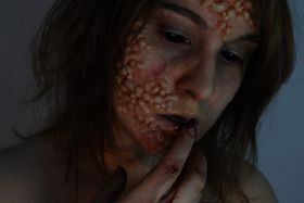Racimo de bultos brillantes, como burbujas de piel, que cubre la mejilla y parte de la frente; un dedo con sangre toca el labio