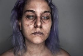 Piel apagada y amoratada, con ojeras hundidas, ojos de un gris lechoso y labios resecos y agrietados