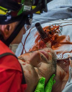 Bombero junto a un herido tumbado con un tubo clavado en la frente y la cara manchada de sangre